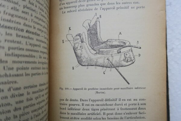 Prothèse restauratrice bucco-faciale et traitement des fractures..1915 – Image 11