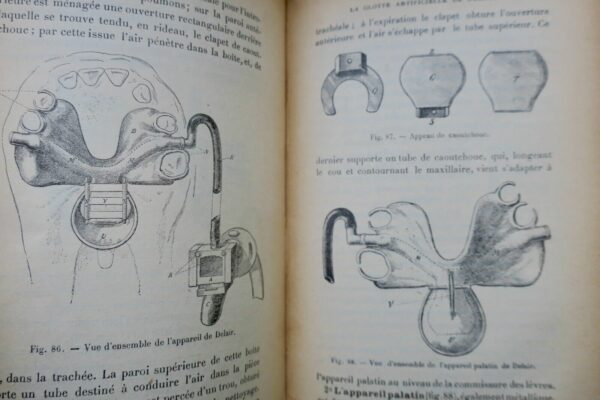 Prothèse restauratrice bucco-faciale et traitement des fractures..1915 – Image 12