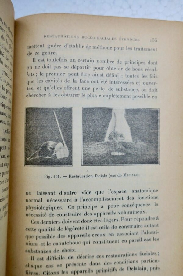 Prothèse restauratrice bucco-faciale et traitement des fractures..1915 – Image 6