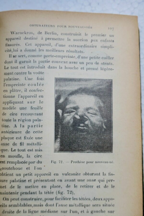 Prothèse restauratrice bucco-faciale et traitement des fractures..1915 – Image 7