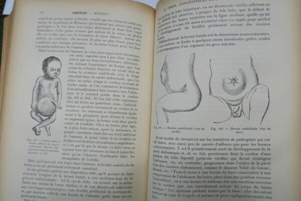 chirurgie Traité de Chirurgie clinique et opératoire 1896 – Image 4