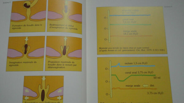 constipation Guide pratique de la constipation – Image 5