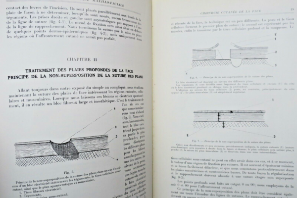 Chirurgie réparatrice maxillo-faciale. Autoplasties - Prothèse - 1940 – Image 11