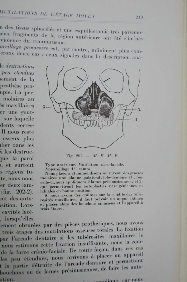 Chirurgie réparatrice maxillo-faciale. Autoplasties - Prothèse - 1940 – Image 4