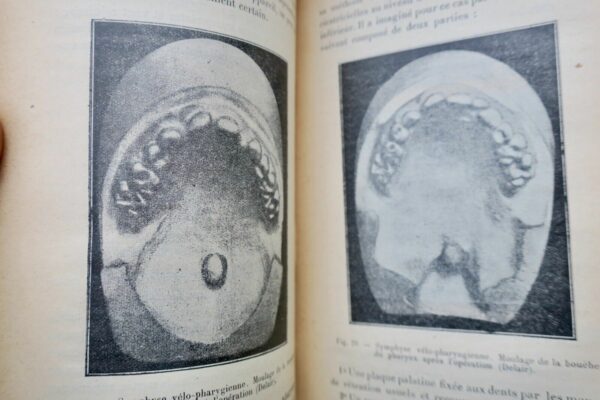 Prothèse restauratrice bucco-faciale et traitement des fractures..1915 – Image 9