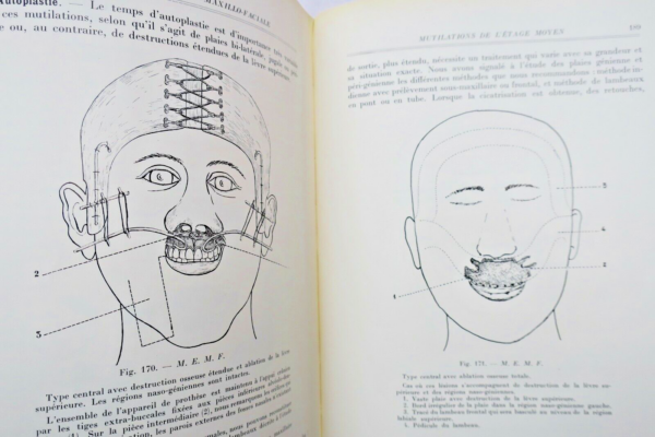 Chirurgie réparatrice maxillo-faciale. Autoplasties - Prothèse - 1940 – Image 3