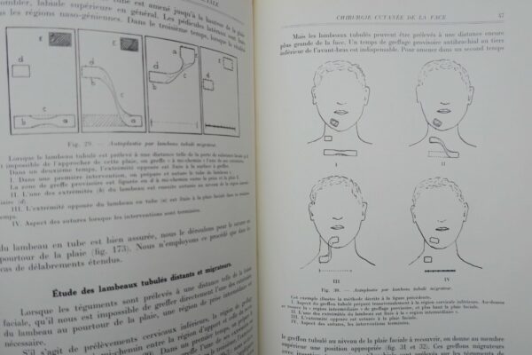 Chirurgie réparatrice maxillo-faciale. Autoplasties - Prothèse - 1940 – Image 10