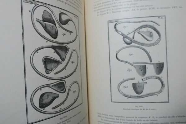 Bandage Herniaire. Autrefois Aujourd'hui 1899 – Image 10