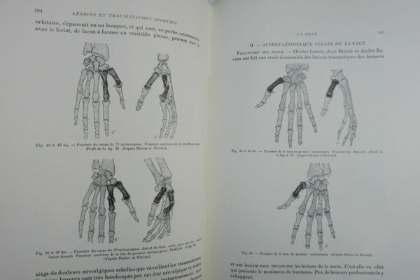 LESIONS ET TRAUMATISMES SPORTIFS 1938 – Image 8