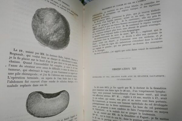 chirurgie  MEMOIRES SUR LA GALVANOCAUSTIQUE THERMIQUE 1876 – Image 3