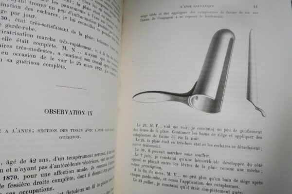 chirurgie  MEMOIRES SUR LA GALVANOCAUSTIQUE THERMIQUE 1876 – Image 6