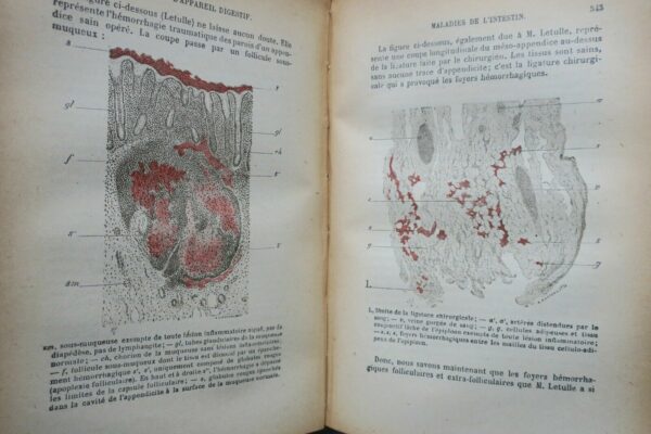 pathologie DIEULAFOY MANUEL DE PATHOLOGIE INTERNE 1918 – Image 8