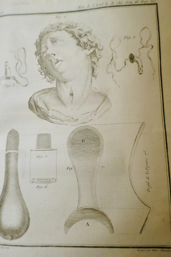 chirurgie Mémoires de l'Académie Royale de Chirurgie 1784 – Image 14