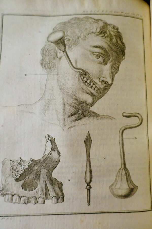 chirurgie Mémoires de l'Académie Royale de Chirurgie 1784