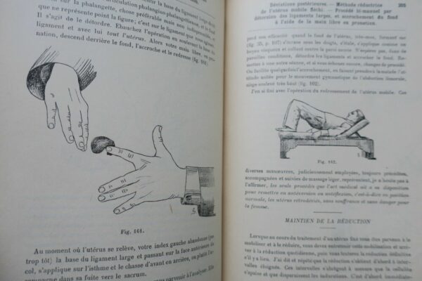 érotique Traité de kinésithérapie gynécologique (massage et gymnastique) 1897 – Image 6