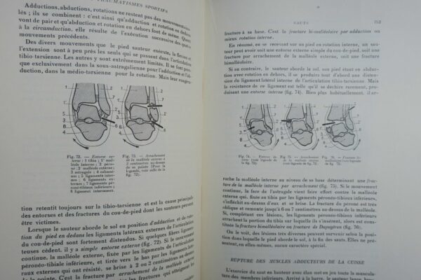 LESIONS ET TRAUMATISMES SPORTIFS 1938 – Image 7