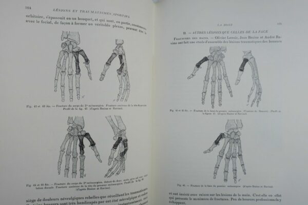 LESIONS ET TRAUMATISMES SPORTIFS 1938 – Image 8