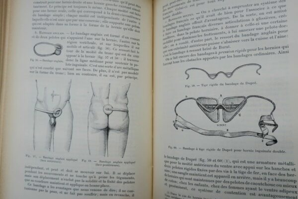 chirurgie Traité de Chirurgie clinique et opératoire 1896 – Image 5