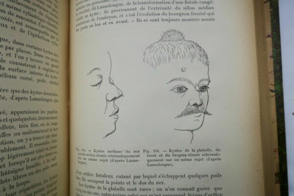 chirurgie Traité de Chirurgie clinique et opératoire 1896 – Image 6