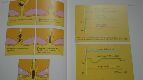 constipation Guide pratique de la constipation – Image 5