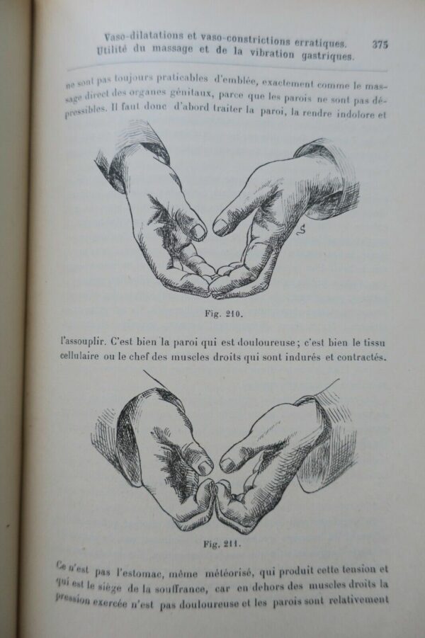 érotique Traité de kinésithérapie gynécologique (massage et gymnastique) 1897 – Image 12